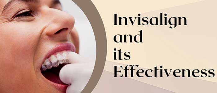 Invisalign and its Effectiveness